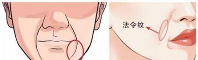 ​怎样去法令纹最快最有效的小窍门(热敷后刮痧)