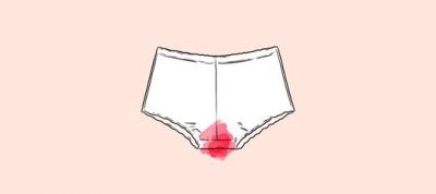 ​「科普」月经量多少算正常？一招教你快速判断大、小姨妈